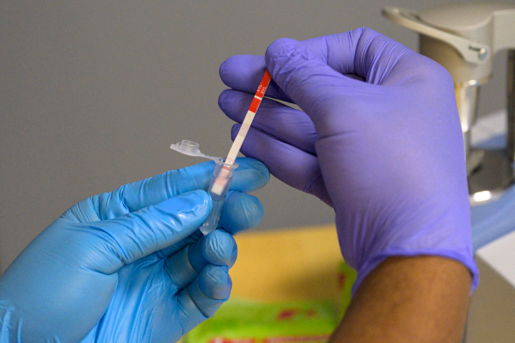 Two gloved hands (blue and purple) hold a test strip into a sample container.