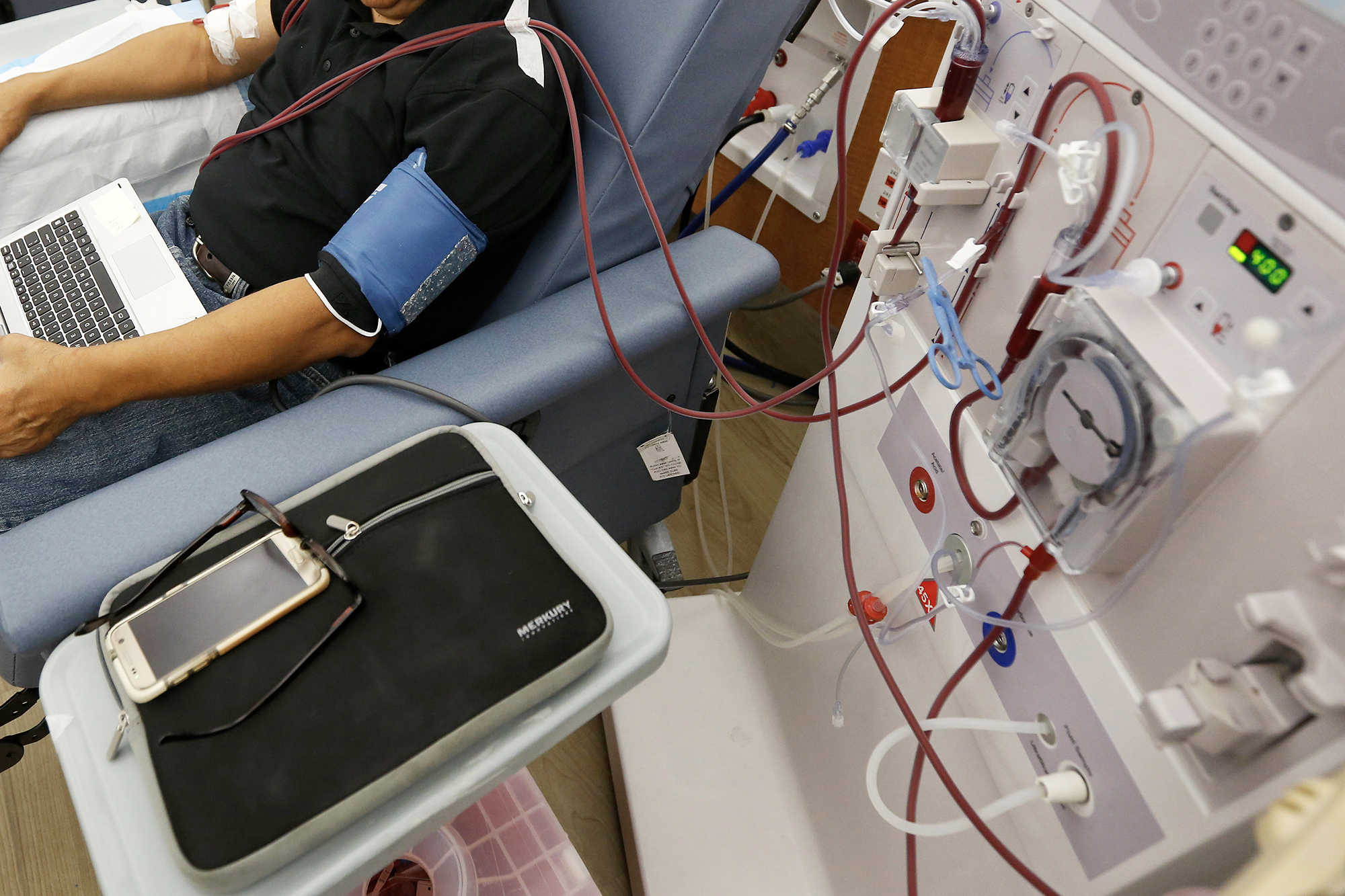 Wires and an arm attached with wires to a machine.
