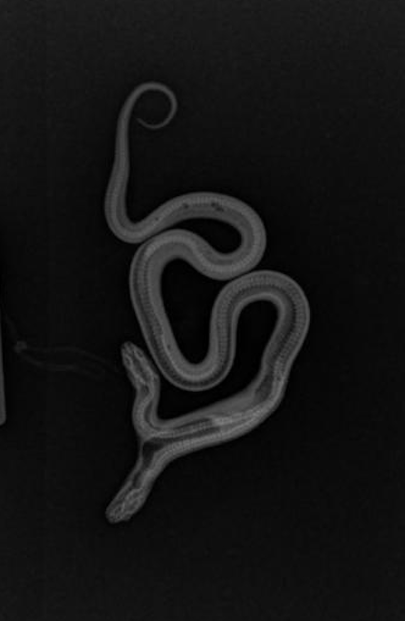 An x-ray of a two headed snake.