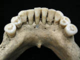 What a Blue Speck Found in Ancient Teeth Could Reveal About Female
Artists in the Middle Ages